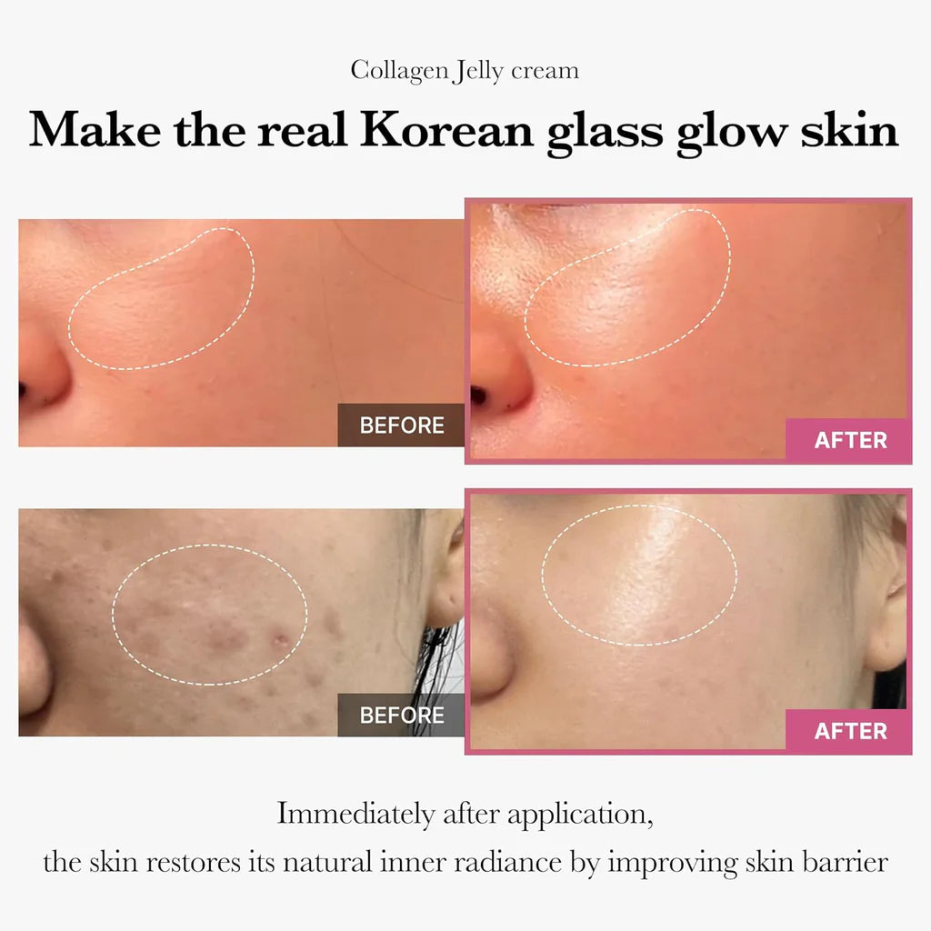 Hidratante Medicube PDRN Collagen Jelly