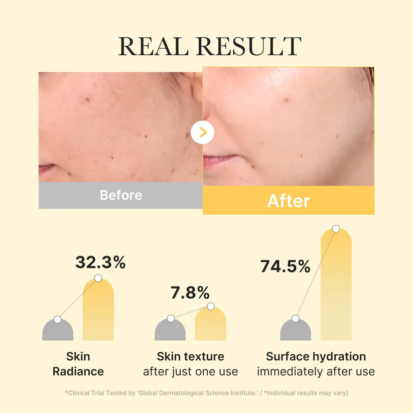 Mascarilla de gel iluminadora con ácido kójico y cúrcuma