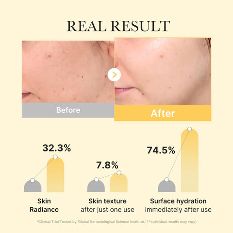 Mascarilla de gel iluminadora con ácido kójico y cúrcuma